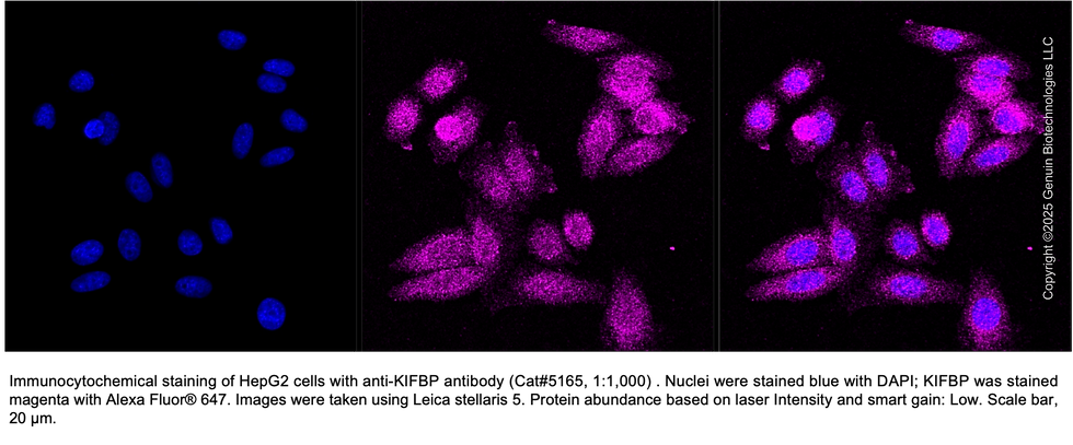 Thumbnail: Anti-KIFBP Mouse Oligoclonal Ab #5165