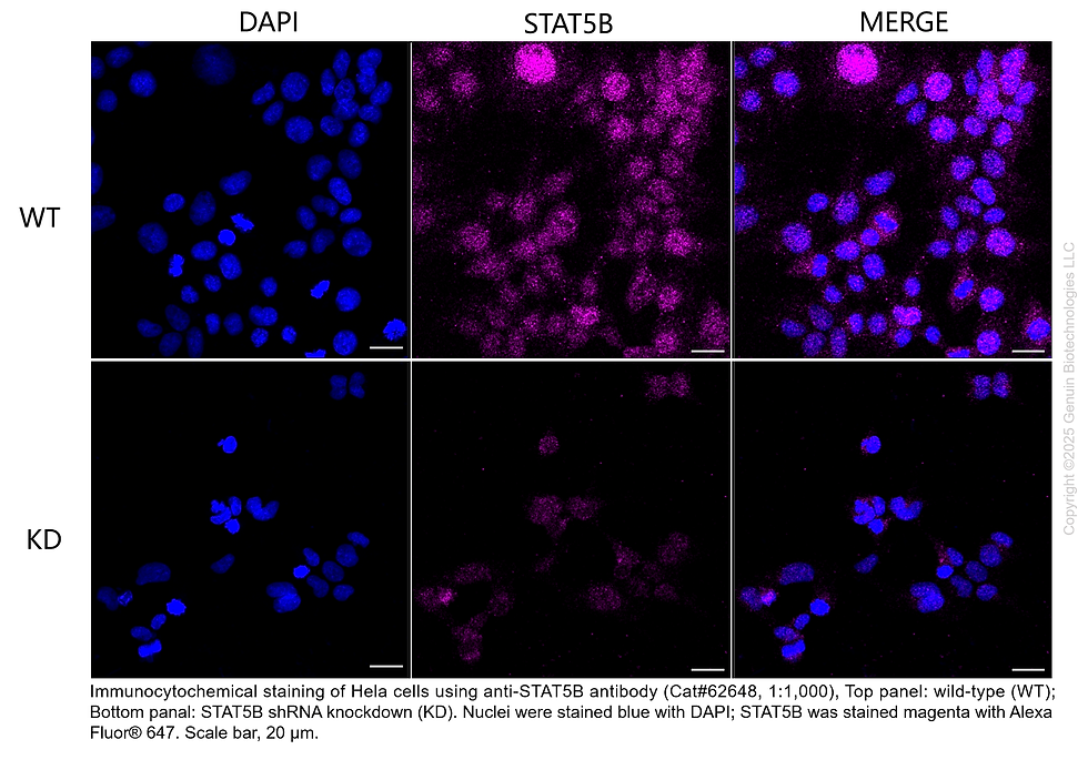 Thumbnail: KD-Validated Anti-STAT5B Rabbit Monoclonal Ab#62648