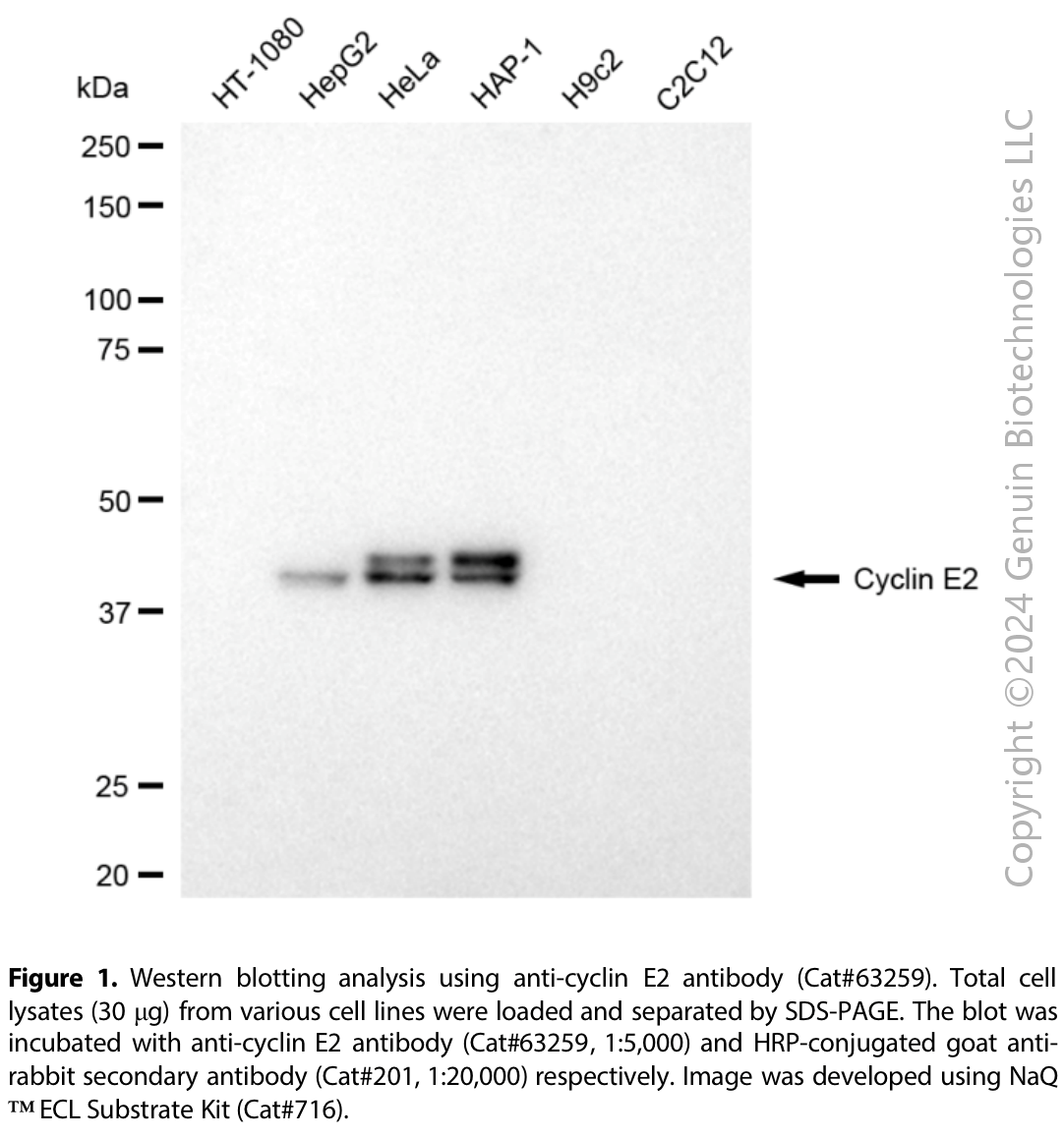 KD-Validated Anti-Cyclin E2 Rabbit Monoclonal Ab#63259