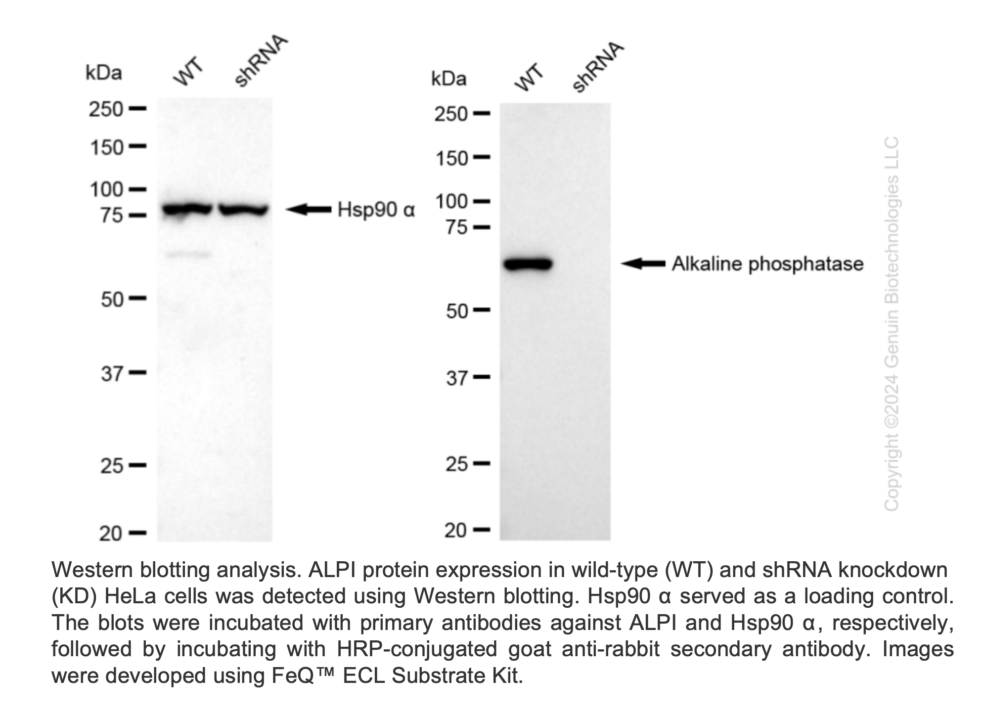 WB-Validated ALPI Lentiviral shRNA Knockdown Kit #V61426