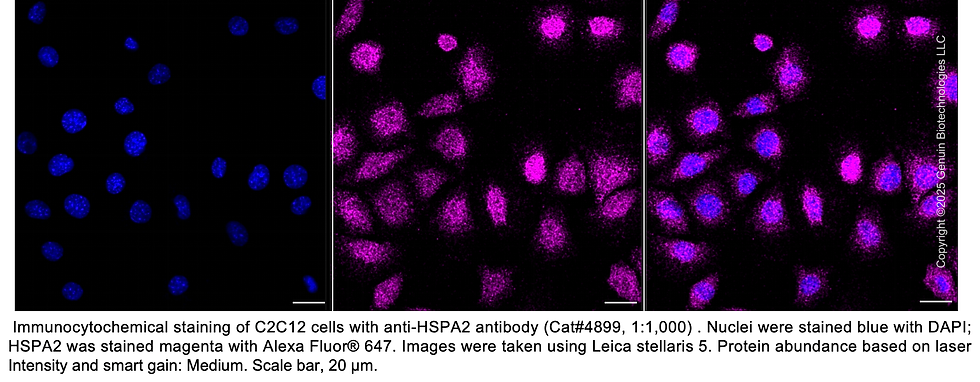 Thumbnail: Anti-HSPA2 Rabbit Monoclonal Ab #4899