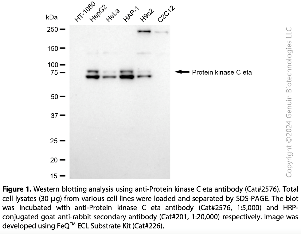 Thumbnail: Anti-Protein Kinase C Eta Rabbit mAb #2576