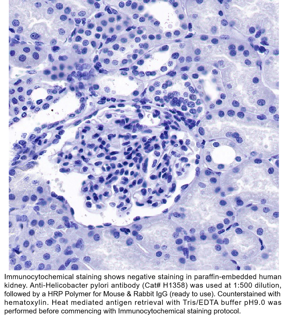 Thumbnail: Anti-Helicobacter pylori Rabbit Monoclonal Ab #H1358