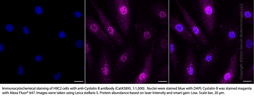 Thumbnail: Anti-Cystatin B Rabbit mAb #2895