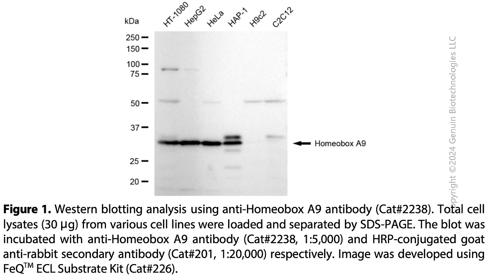 Thumbnail: Anti-Homeobox A9 Rabbit mAb #2238