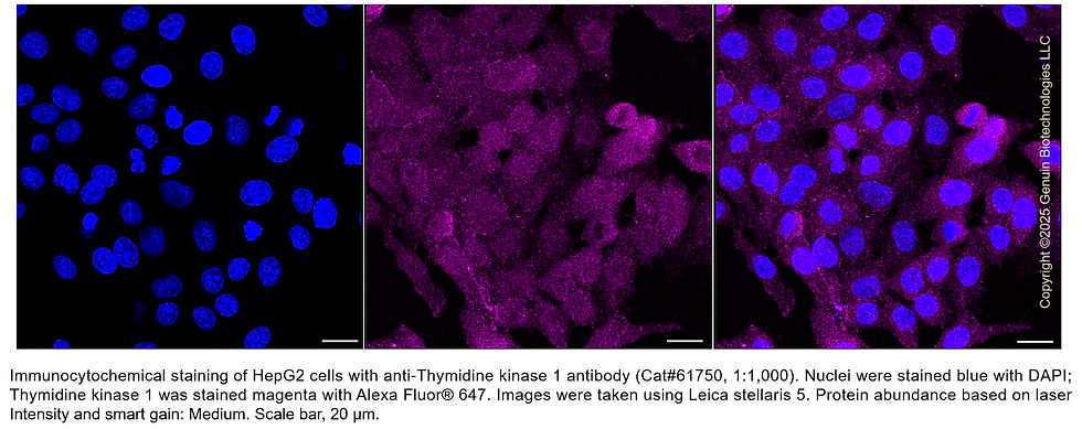 Thumbnail: KD-Validated Anti-Thymidine Kinase 1 Rabbit mAb #61750