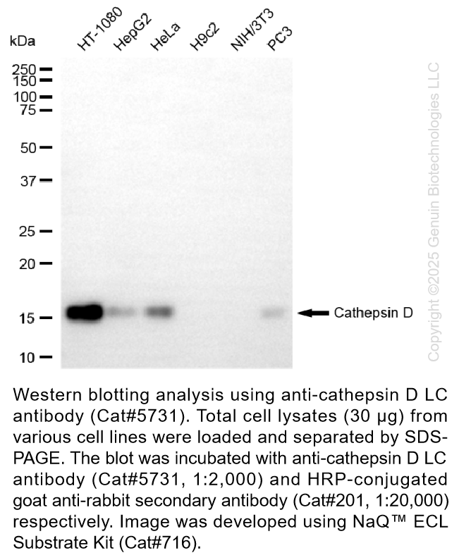 Anti-Cathepsin D LC Rabbit Polyclonal Ab #5731