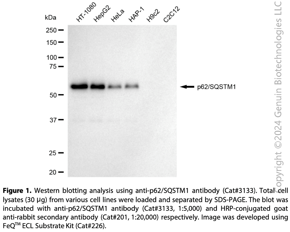 Thumbnail: Anti-Sequestosome 1 Rabbit mAb #3133