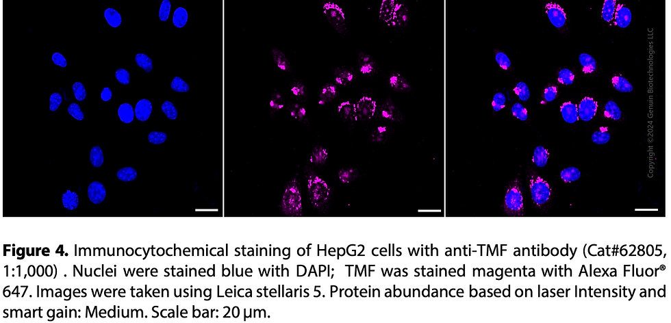 Thumbnail: KD-Validated Anti-TATA Element Modulatory Factor 1 Rabbit Monoclonal Ab#62805