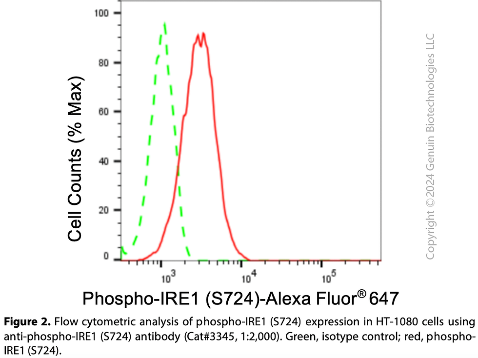 Thumbnail: Anti-Phospho-IRE1 (S724) Rabbit mAb #3345