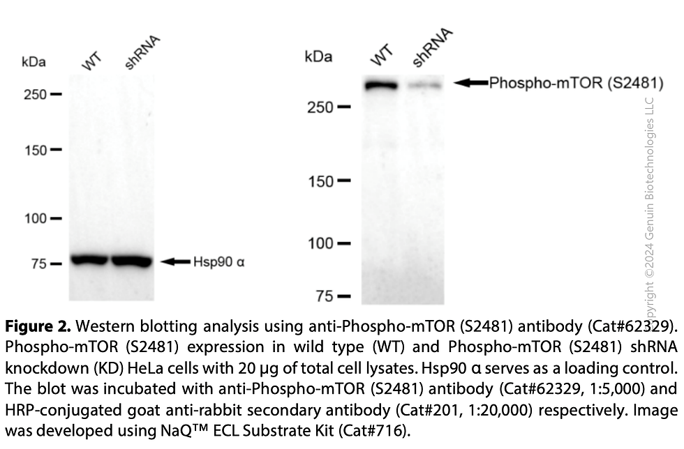 Thumbnail: KD-Validated Anti-Phospho-mTOR (S2448) Rabbit Monoclonal Ab#62330