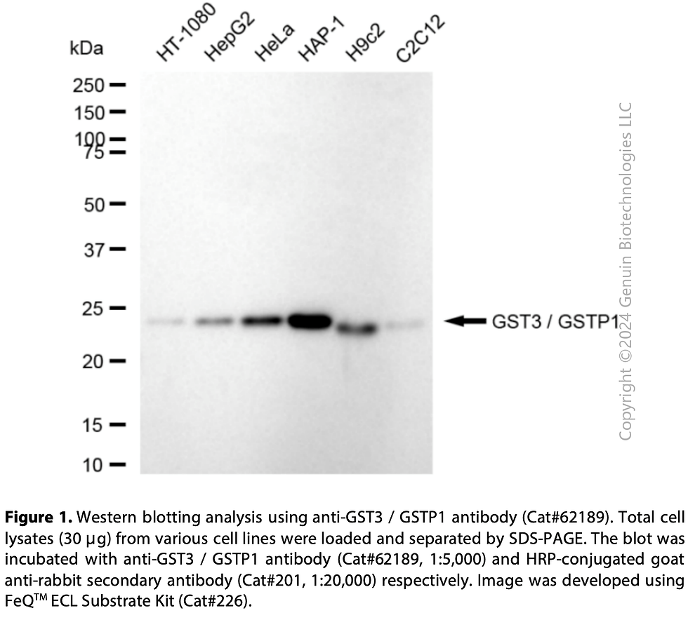 Thumbnail: KD-Validated Anti-GST3 / GSTP1 Rabbit mAb#62189