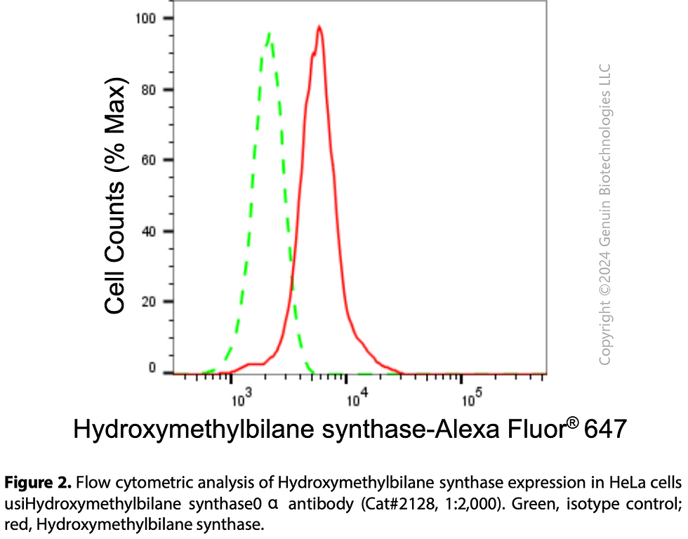 Thumbnail: Anti-Hydroxymethylbilane Synthase Rabbit mAb #2128