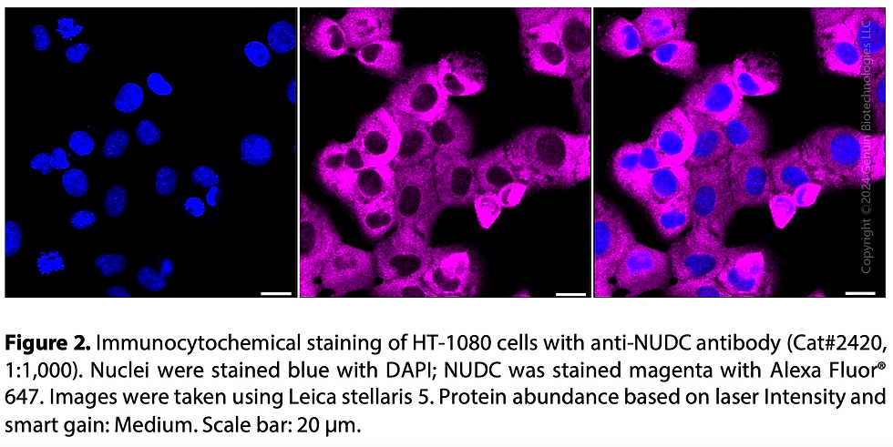 Thumbnail: Anti-NUDC Rabbit mAb #2420