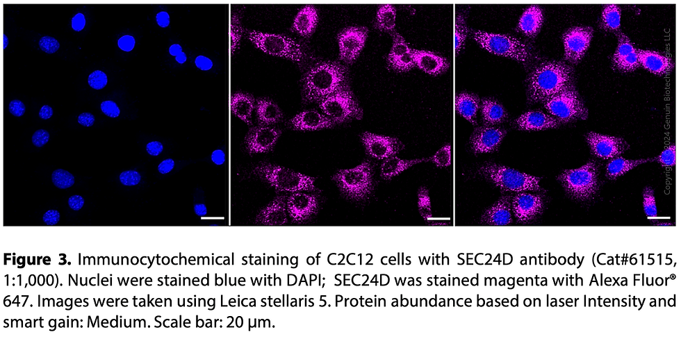 Thumbnail: KD-Validated Anti-SEC24D Rabbit Monoclonal Ab#61515