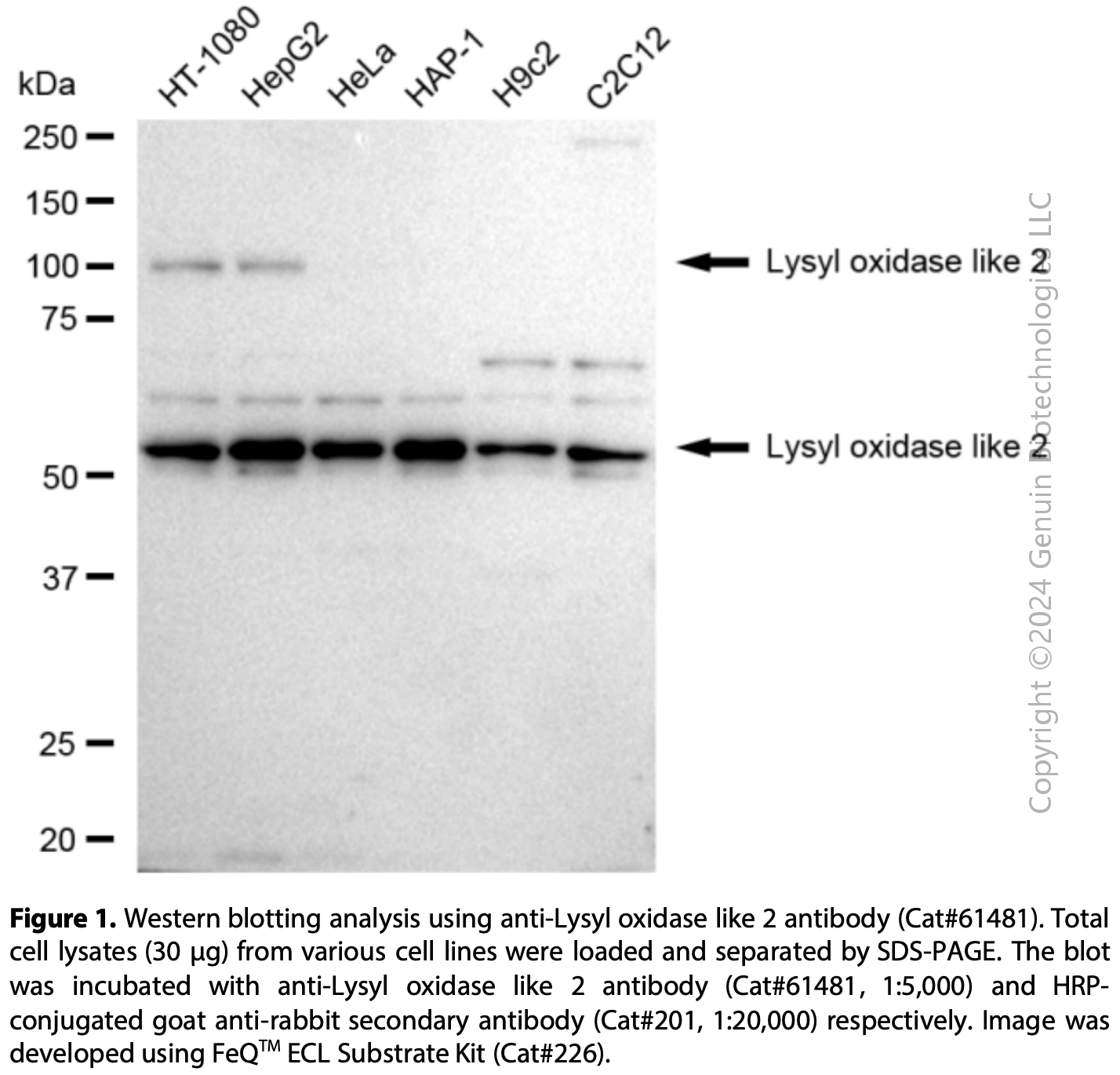 KD-Validated Anti-Lysyl Oxidase Like 2 Rabbit Monoclonal Ab#61481