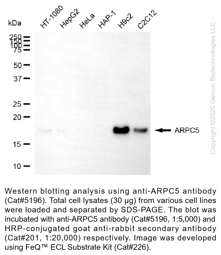 Anti-ARPC5 Rabbit Monoclonal Antibody #5196