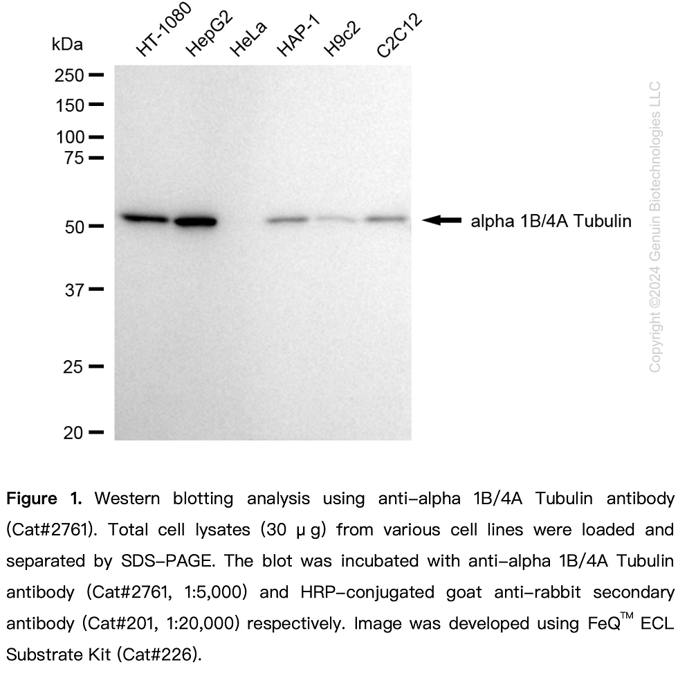 Thumbnail: Anti-TUBA1B/TUBA4A Rabbit mAb #2761