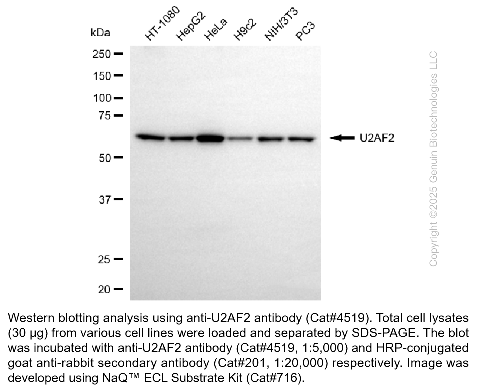Anti-U2AF2 Rabbit Monoclonal Ab #4519