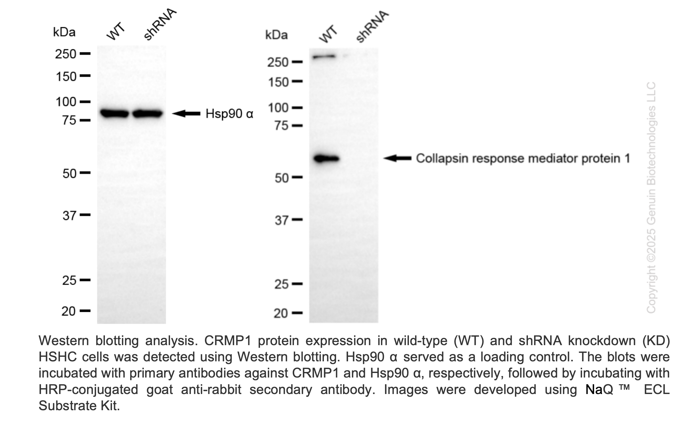 WB-Validated CRMP1 Lentiviral shRNA Knockdown Kit #V61315