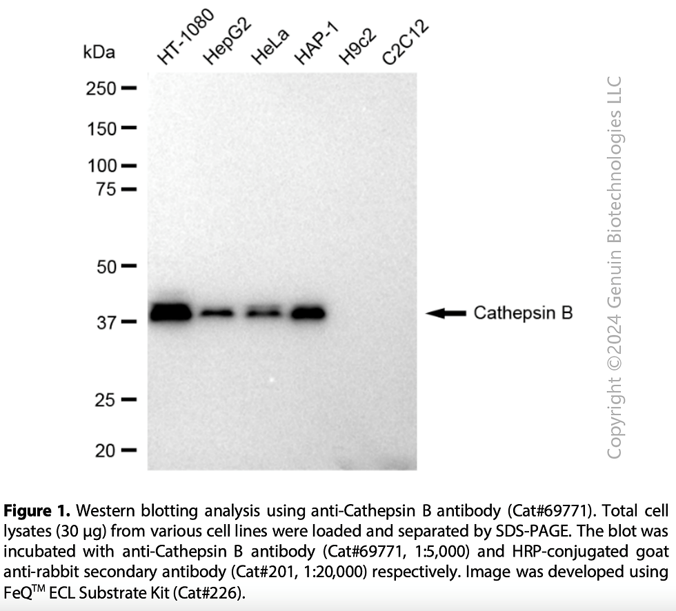 KD-Validated Anti-Cathepsin B Rabbit Moclonal Ab#69771