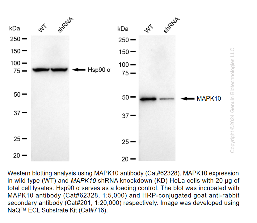 Thumbnail: KD-Validated Anti-MAPK10 Rabbit Monoclonal Ab#62328