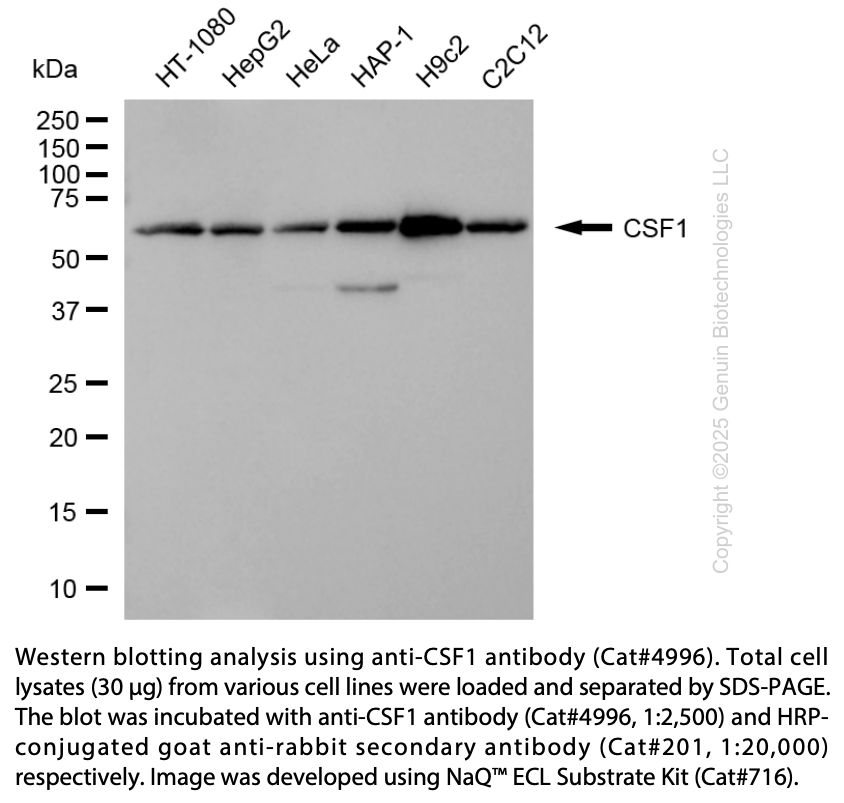 Anti-CSF1 Rabbit Polyclonal Ab #4996