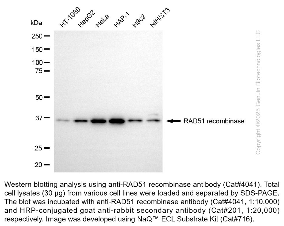 Thumbnail: Anti-RAD51 recombinase Rabbit Monoclonal Ab #4041