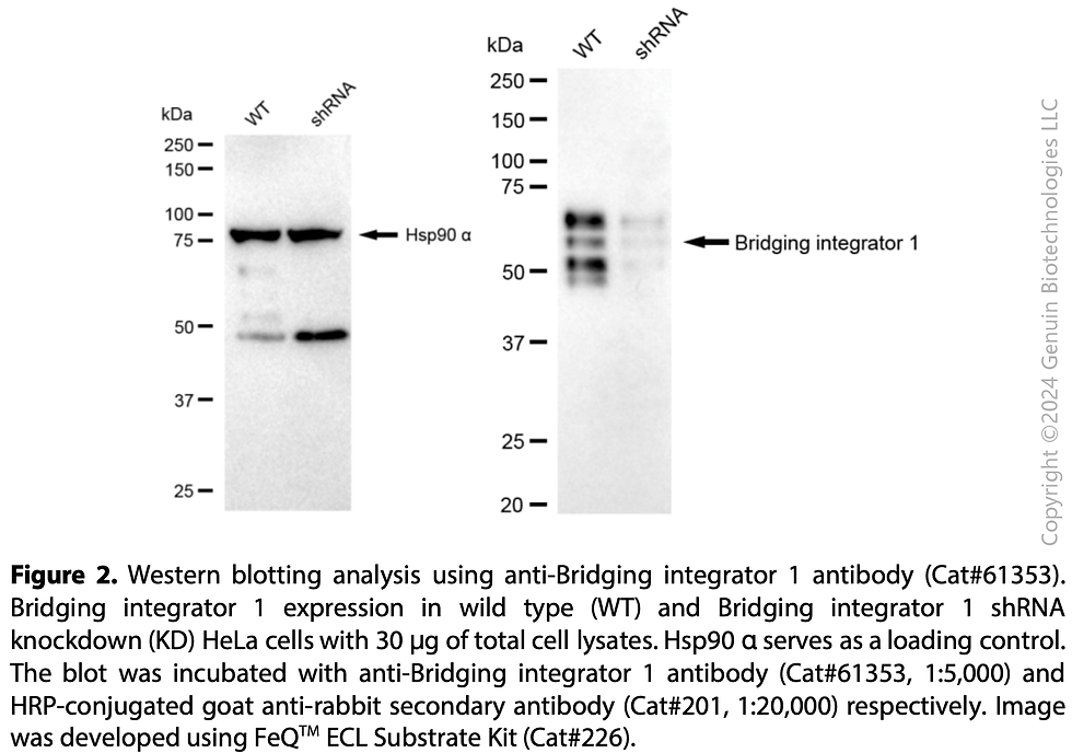Thumbnail: KD-Validated Anti-Bridging Integrator 1 Rabbit Monoclonal Ab#61353