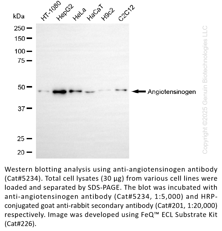 Anti-Angiotensinogen Rabbit Monoclonal Ab #5234