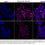 Thumbnail: KD-Validated Anti-Neuronal Calcium Sensor 1 Rabbit Monoclonal Ab#62262