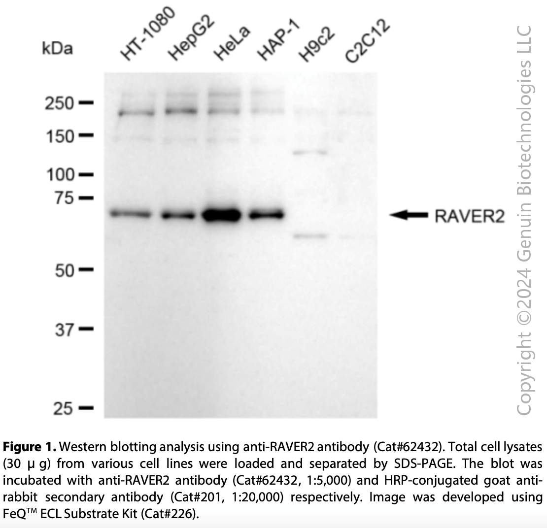 KD-Validated Anti-RAVER2 Rabbit Monoclonal Ab #62432