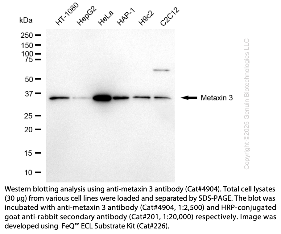 Anti-Metaxin 3 Rabbit Monoclonal Ab #4904