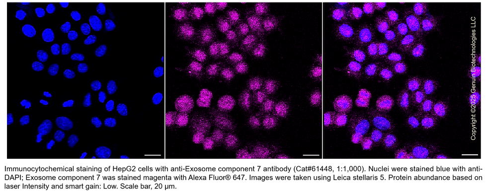 Thumbnail: KD-Validated Anti-Exosome Component 7 Rabbit mAb #61448