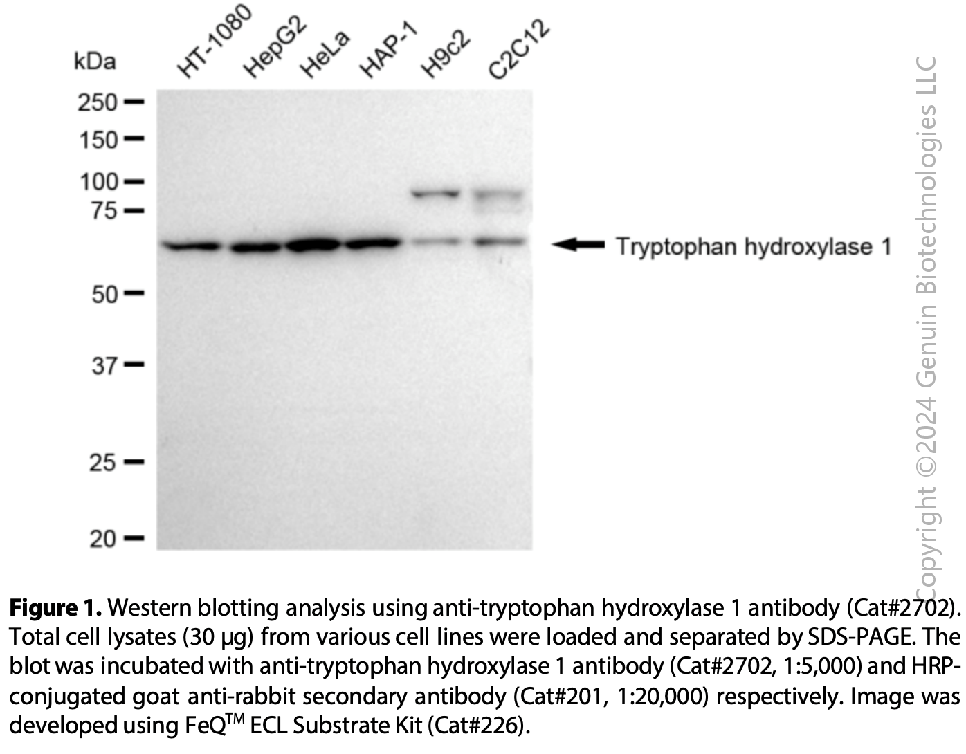 Anti-Tryptophan Hydroxylase 1 Rabbit mAb #2702