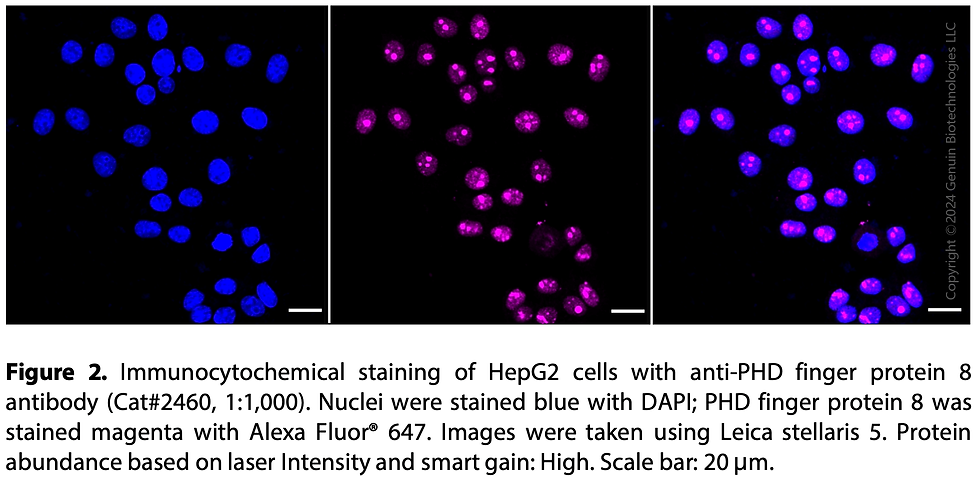 Thumbnail: Anti-PHD Finger Protein 8 Rabbit mAb #2460
