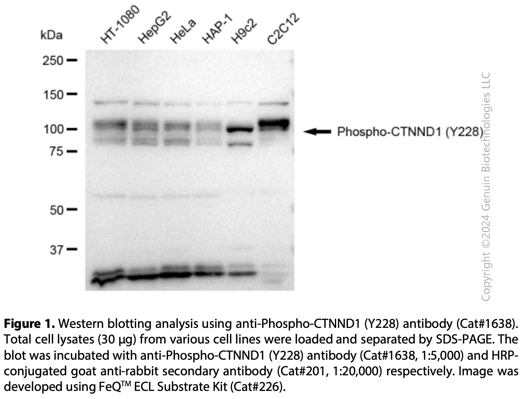 Anti-Phospho-CTNND1 (Y228) Rabbit mAb #1638