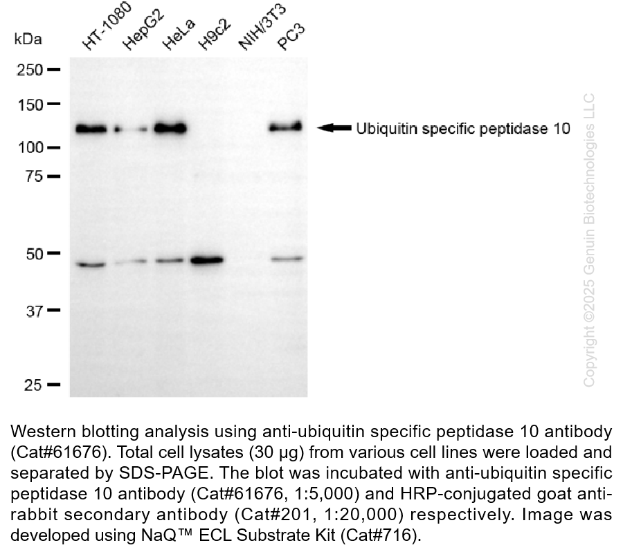 KD-Validated Anti-Ubiquitin Specific Peptidase 10 Rabbit mAb #61676