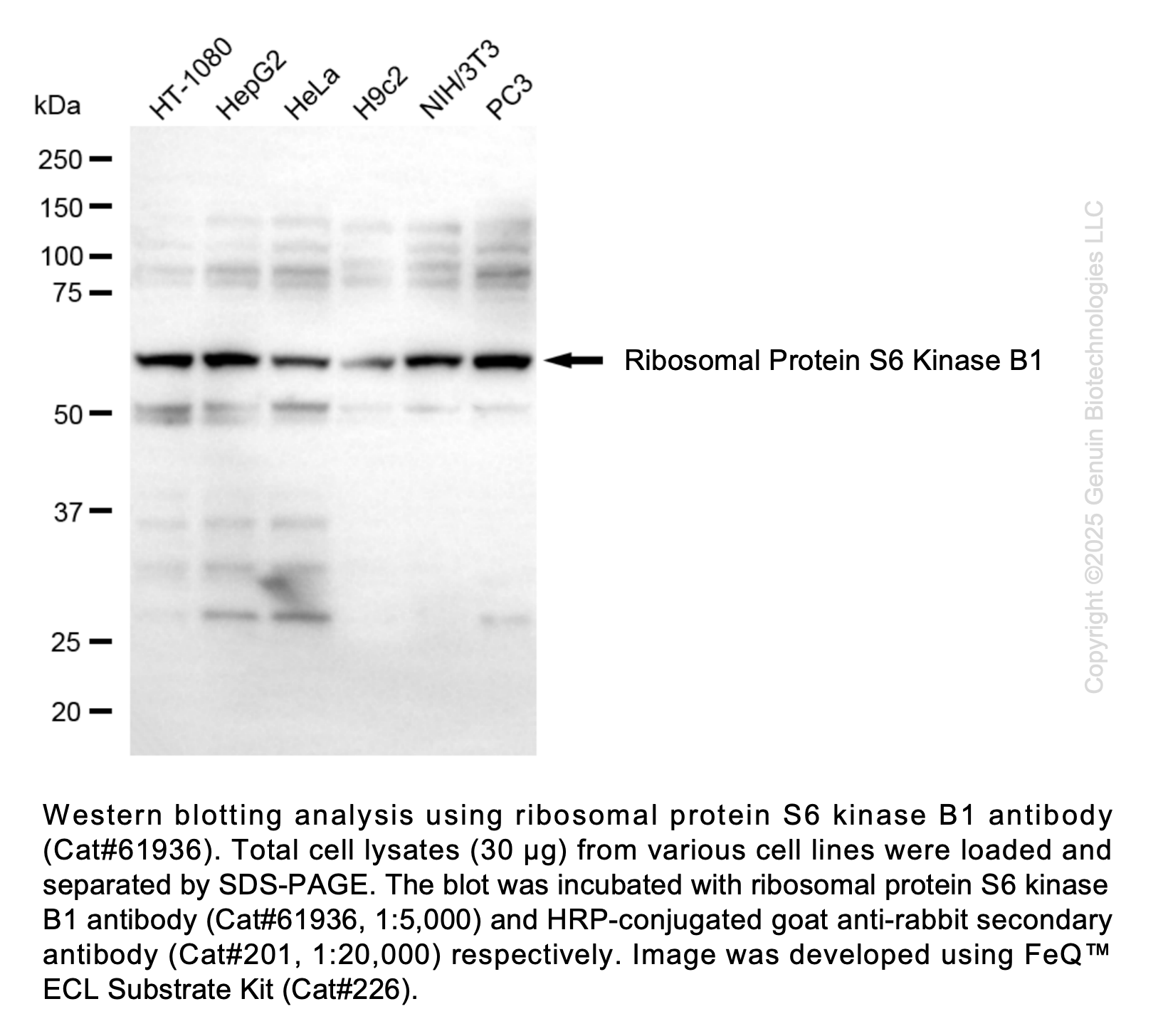 KD-Validated Ribosomal Protein S6 Kinase B1 Recombinant Rabbit mAb #61936