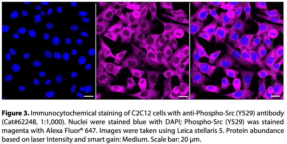 Thumbnail: KD-Validated Anti-Phospho-Src (Y529) Rabbit mAb#62248