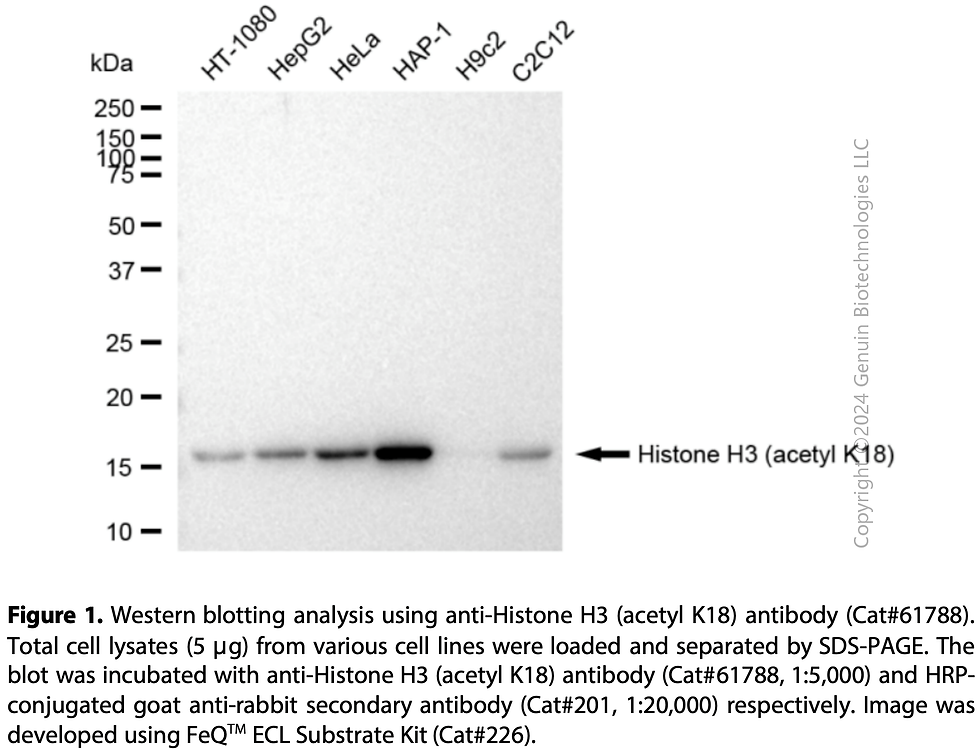 Thumbnail: KD-Validated Anti-Histone H3 (Acetyl K18) Rabbit mAb#61788