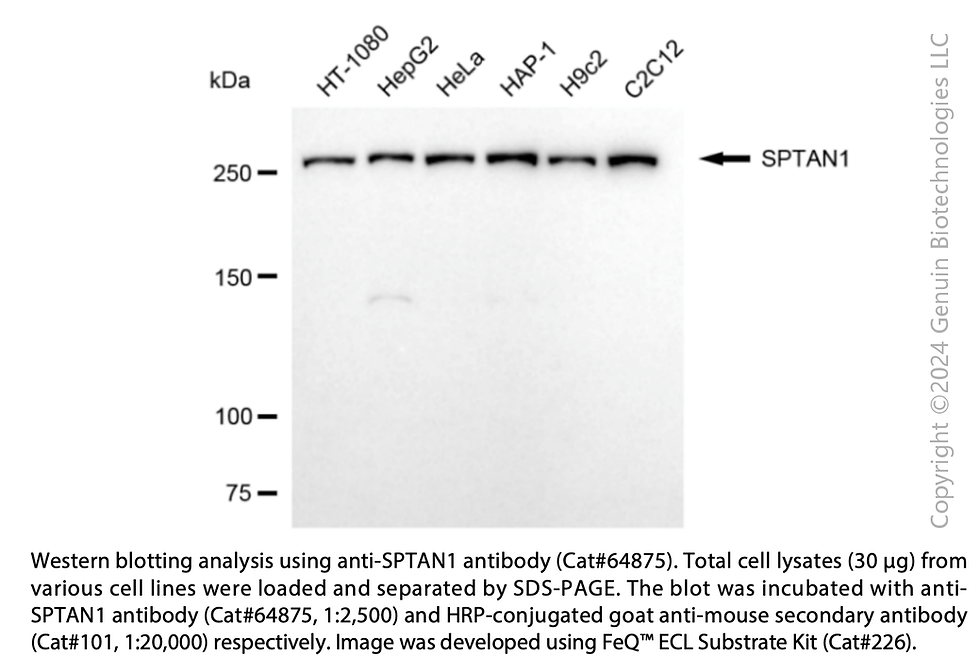 Thumbnail: KD-Validated Anti-SPTAN1 Mouse Monoclonal Ab #64875