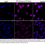 Thumbnail: KD-Validated Anti-PI3 Kinase p110 Beta Rabbit Monoclonal Ab#64311