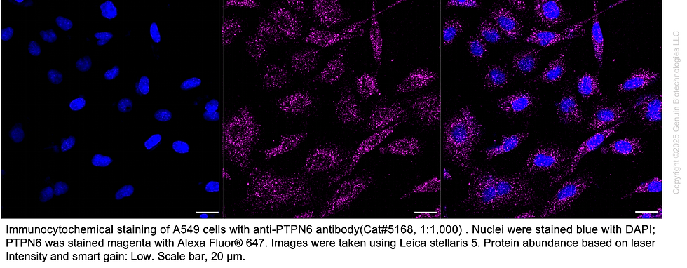 Thumbnail: Anti-PTPN6 Mouse Oligoclonal Ab #5168