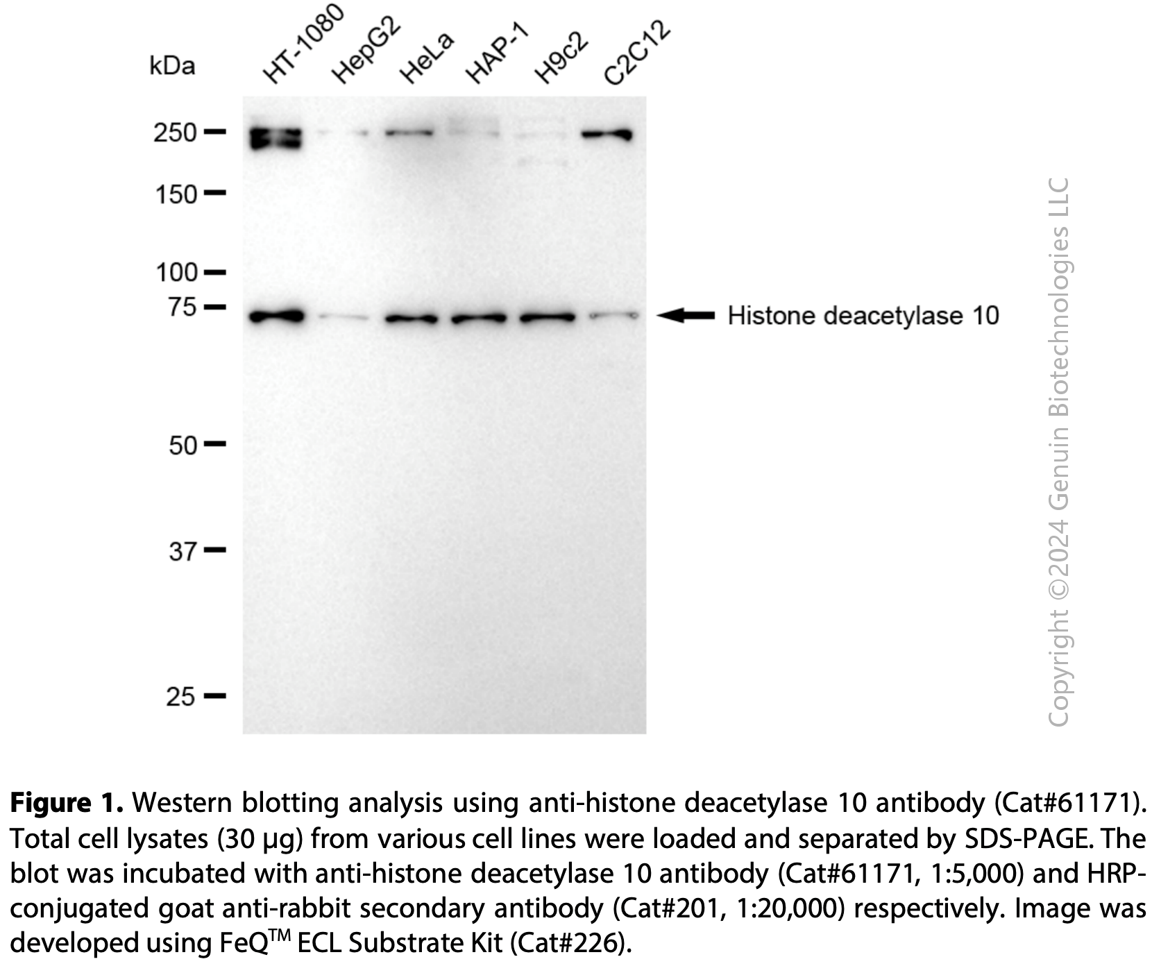 KD-Validated Anti-Histone Deacetylase 10 Rabbit Monoclonal Ab #61171