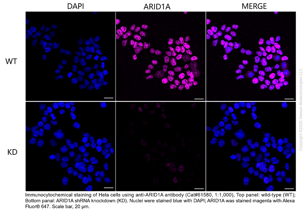 Thumbnail: KD-Validated Anti-ARID1A Rabbit Monoclonal Ab#61580