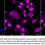 Thumbnail: Anti-Karyopherin Subunit Alpha 2 Rabbit mAb #2161