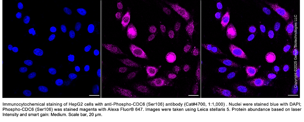 Thumbnail: Anti-Phospho-CDC6 (Ser106) Rabbit Monoclonal Ab #4700