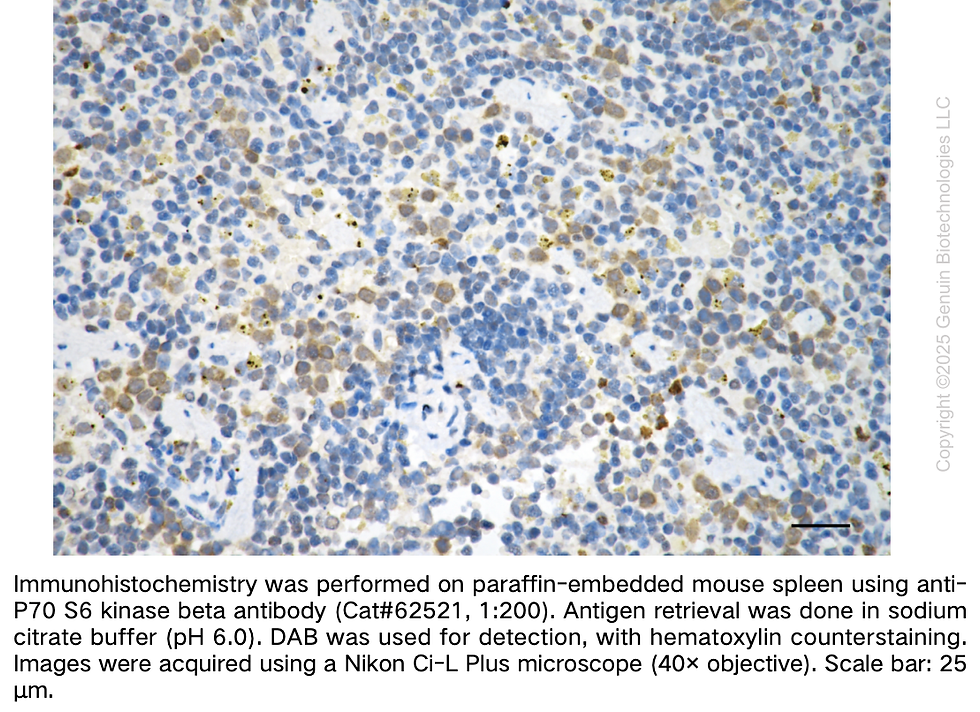Thumbnail: KD-Validated Anti-Ribosomal Protein S6 Kinase B2 Rabbit Monoclonal Ab#62521