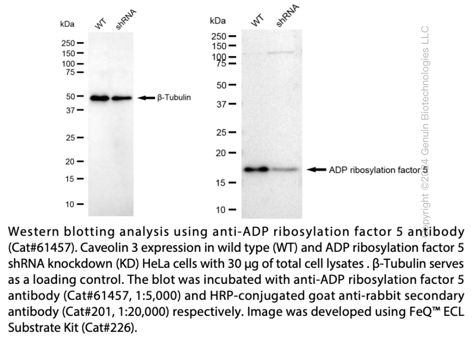 Thumbnail: KD-Validated Anti-ADP Ribosylation Factor 5 Rabbit Monoclonal Ab#61457